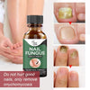 Fast Nail Fungal Treatments Essences Serum Care